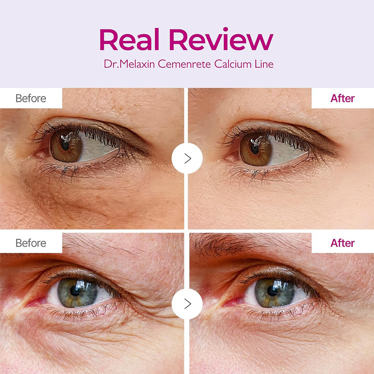 بچ دور چشم دکتر ملاکسین مدل Cemenrete Calcium Volume بسته 60عددی